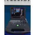 Laptop color doppler ultrasound price & echography DW-C60